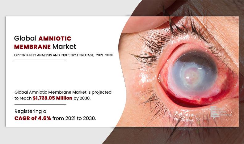 Amniotic Membrane Market Poised for Steady Growth, Reaching $1.7 Billion by 2030