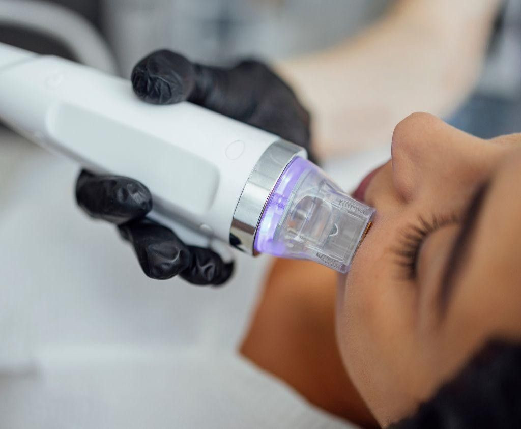 RF Microneedling Explained: Benefits, Results, and What to Expect in Grants Pass