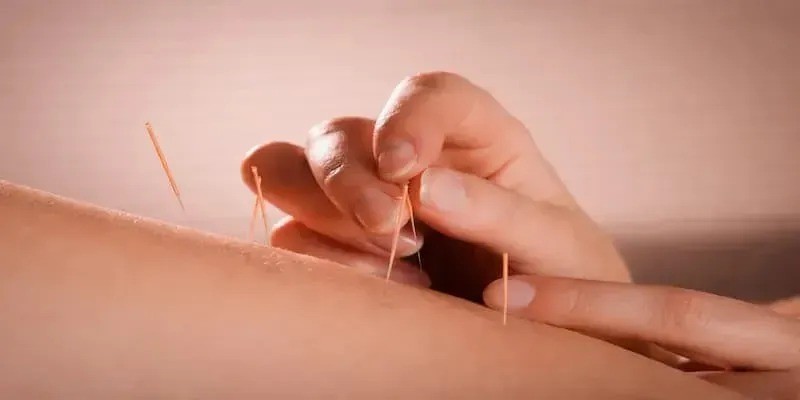 Top Conditions Treated With Acupuncture